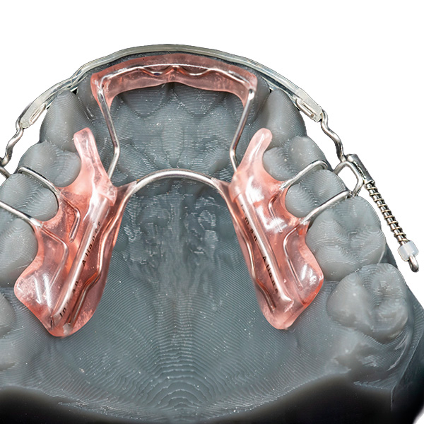 Inman Aligner